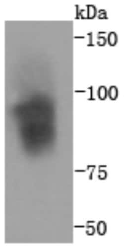 Integrin beta 3/CD61 Antibody (SJ19-09), Novus Biologicals 100&mu;L:Antibodies,